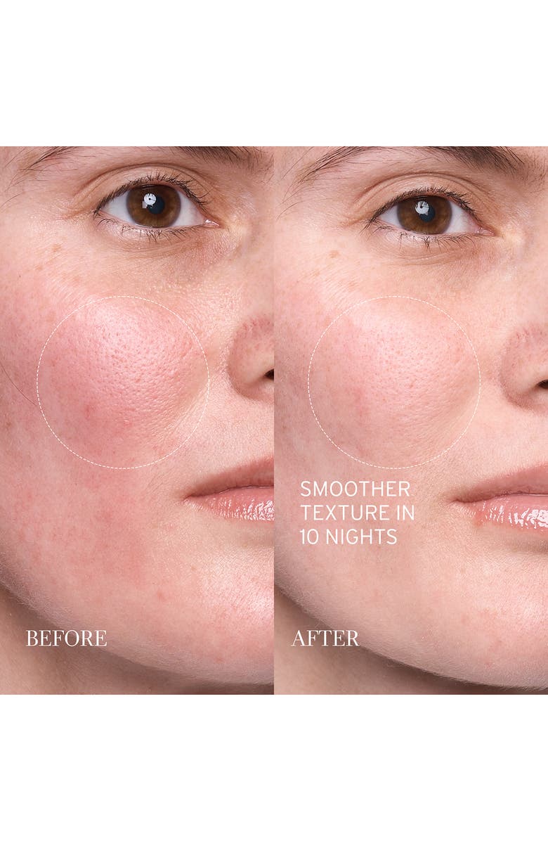 Fresh<sup>®</sup> Lotus Youth Preserve Resurfacing Night Serum, Alternate, color, 