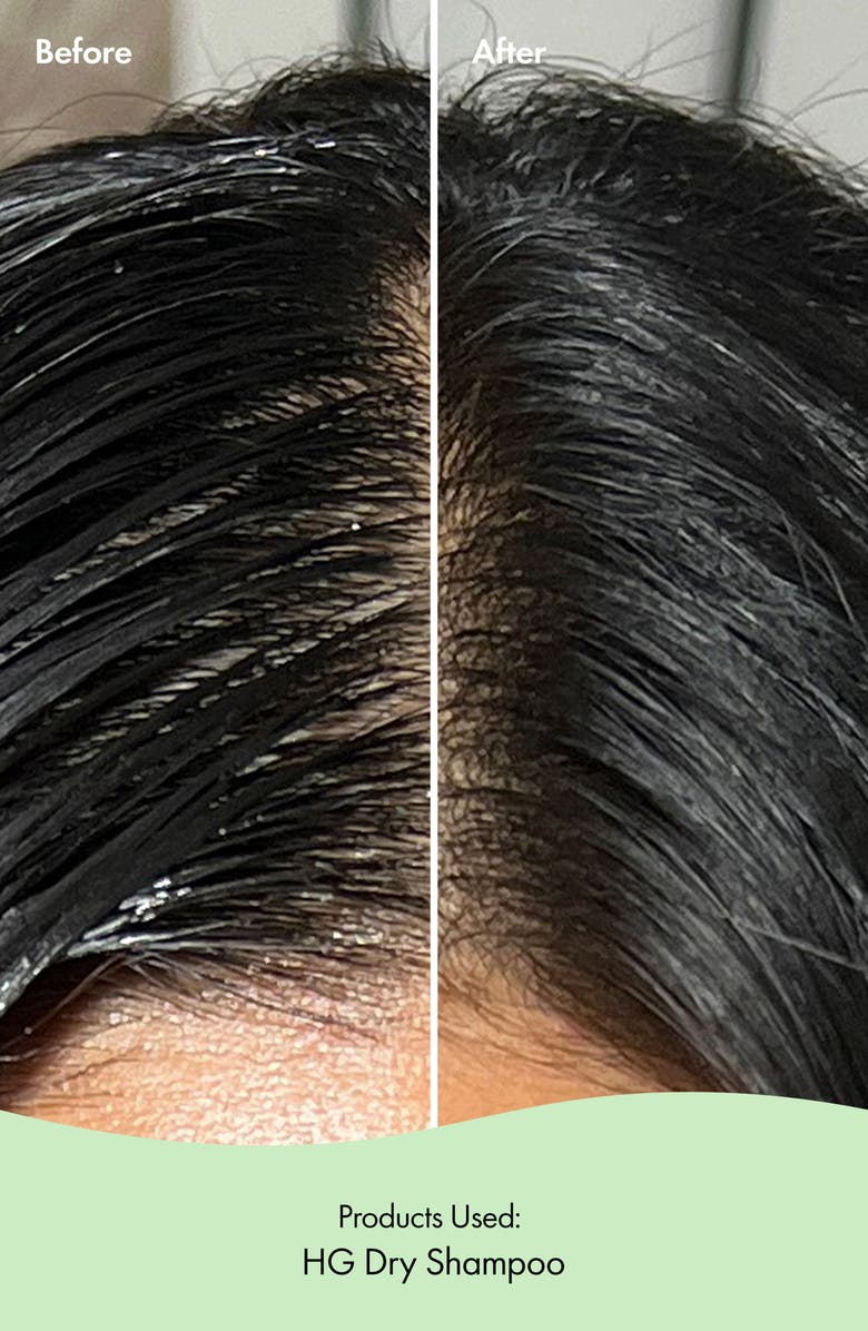 HG Dry Shampoo