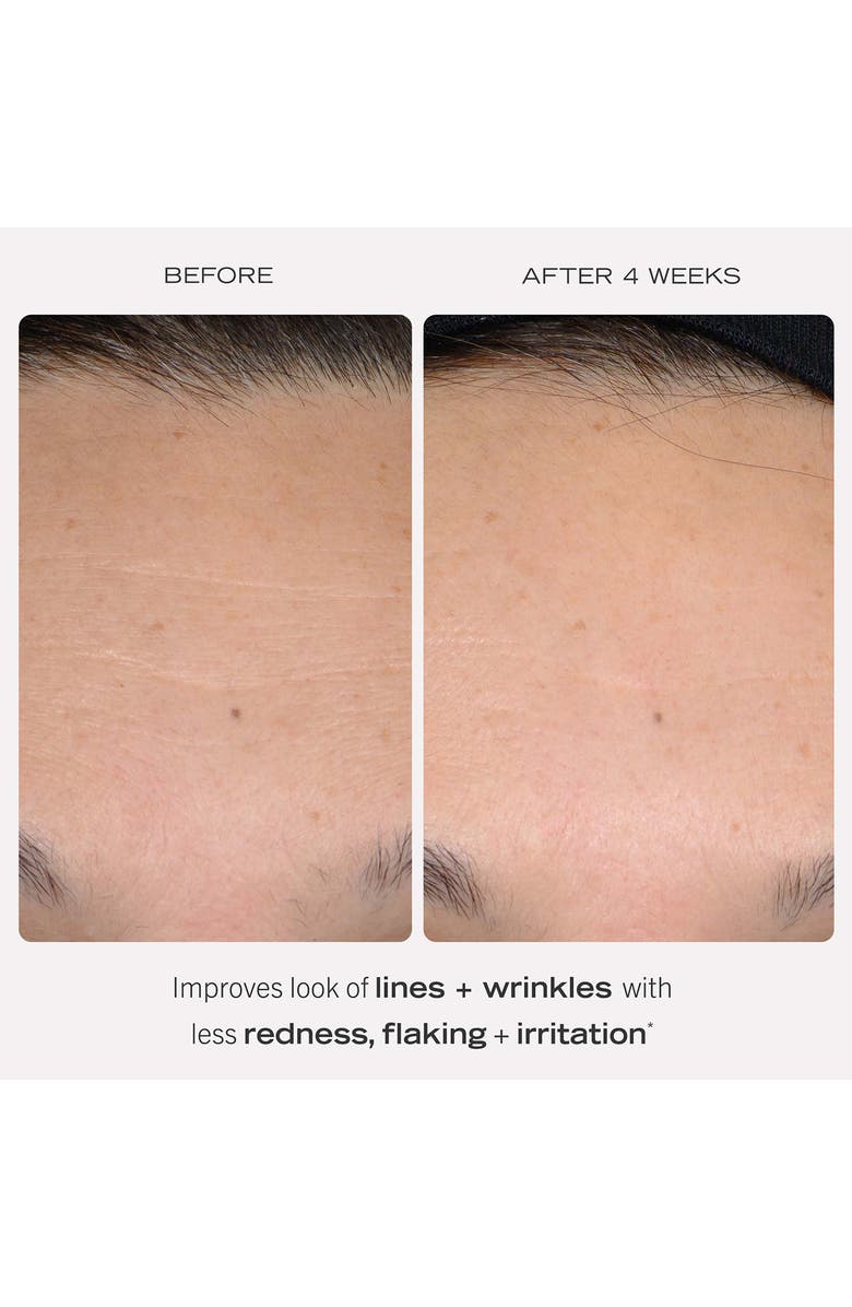 First Aid Beauty 0.3% Retinol Complex Serum with Peptides, Alternate, color,