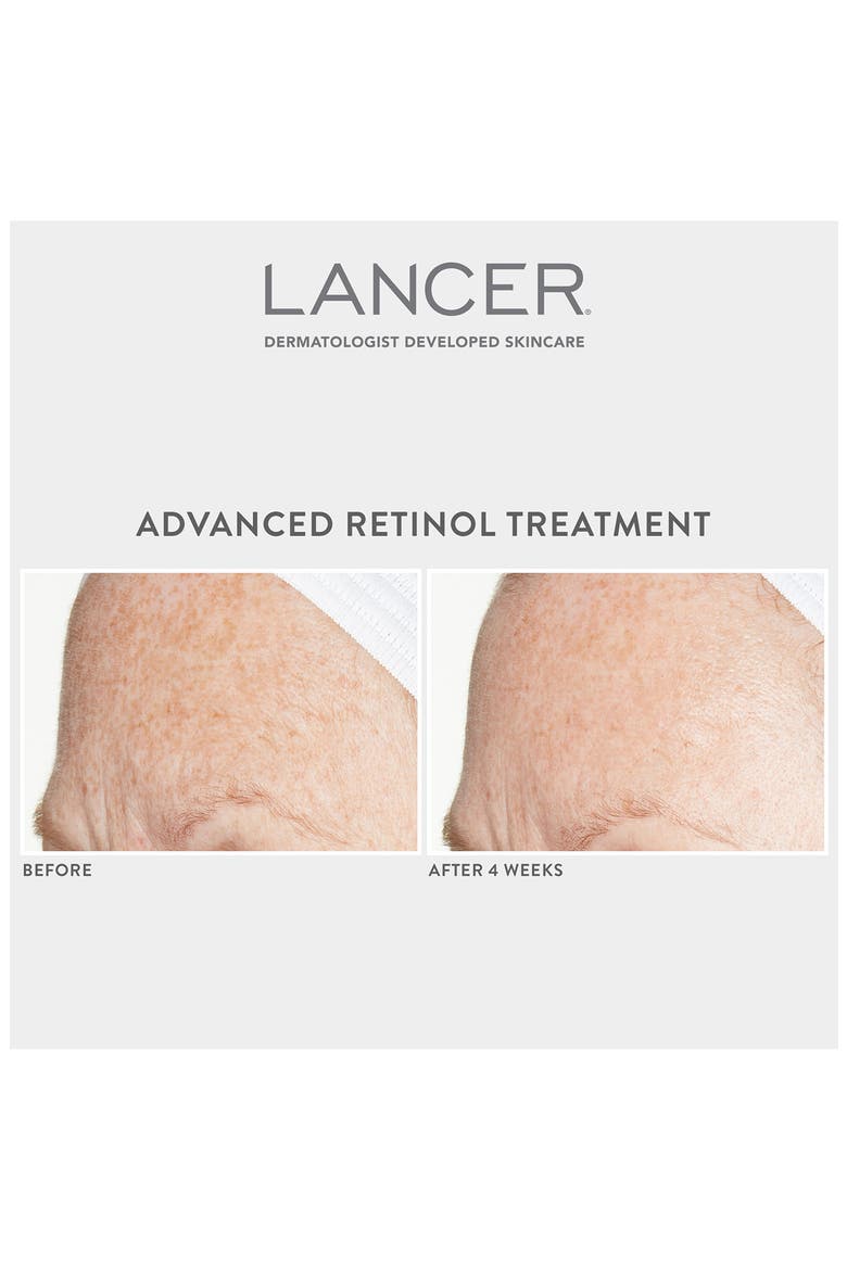 Advanced Retinol Treatment, Alternate, color, NO COLOR