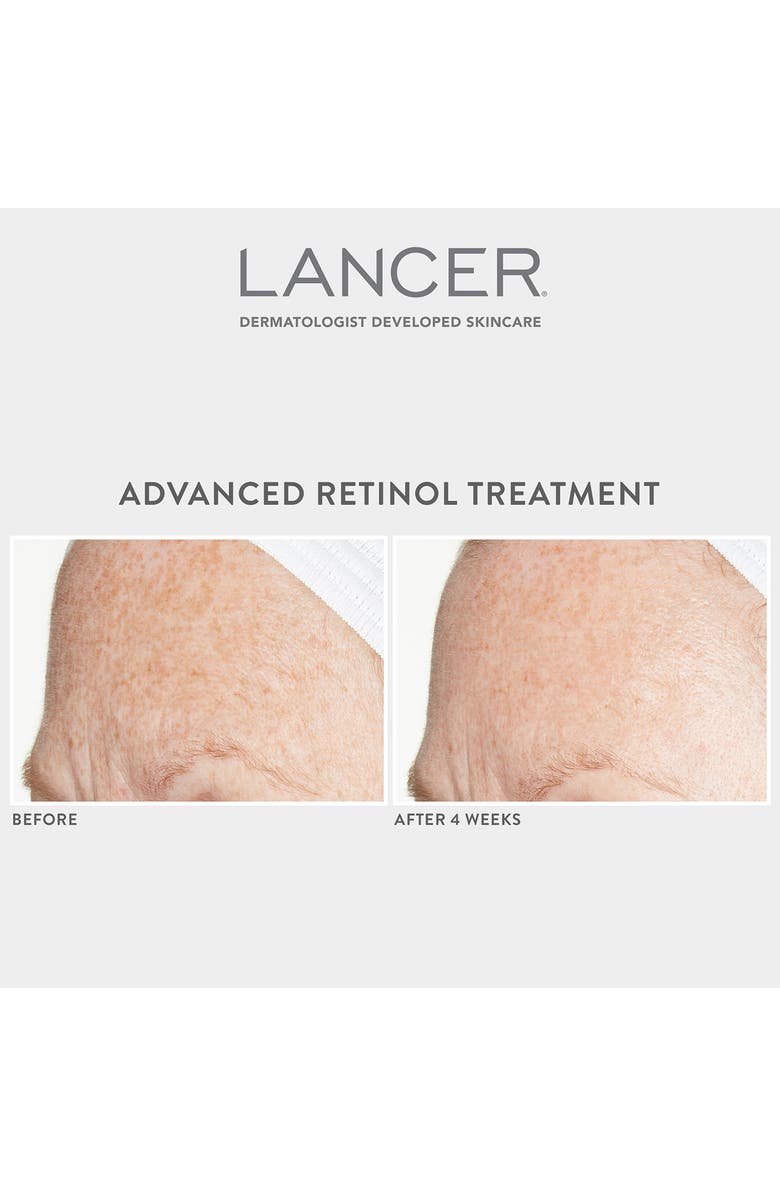 LANCER Skincare Advanced Retinol Treatment, Alternate, color,