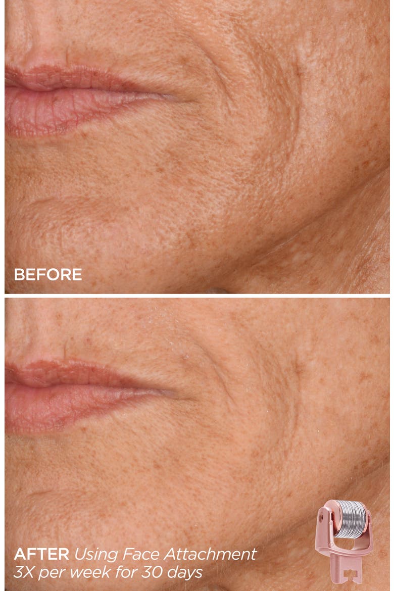 GloPRO® Skin That Glitters Set, Alternate, color, NO COLOR