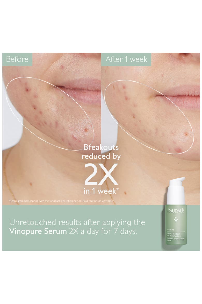 Vinopure Skin Perfecting Serum, Alternate, color, NO COLOR