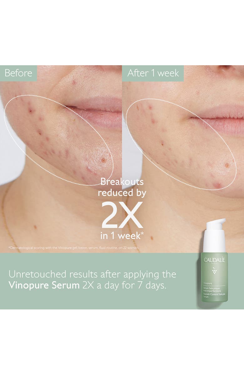 CAUDALÍE Vinopure Skin Perfecting Serum, Alternate, color,