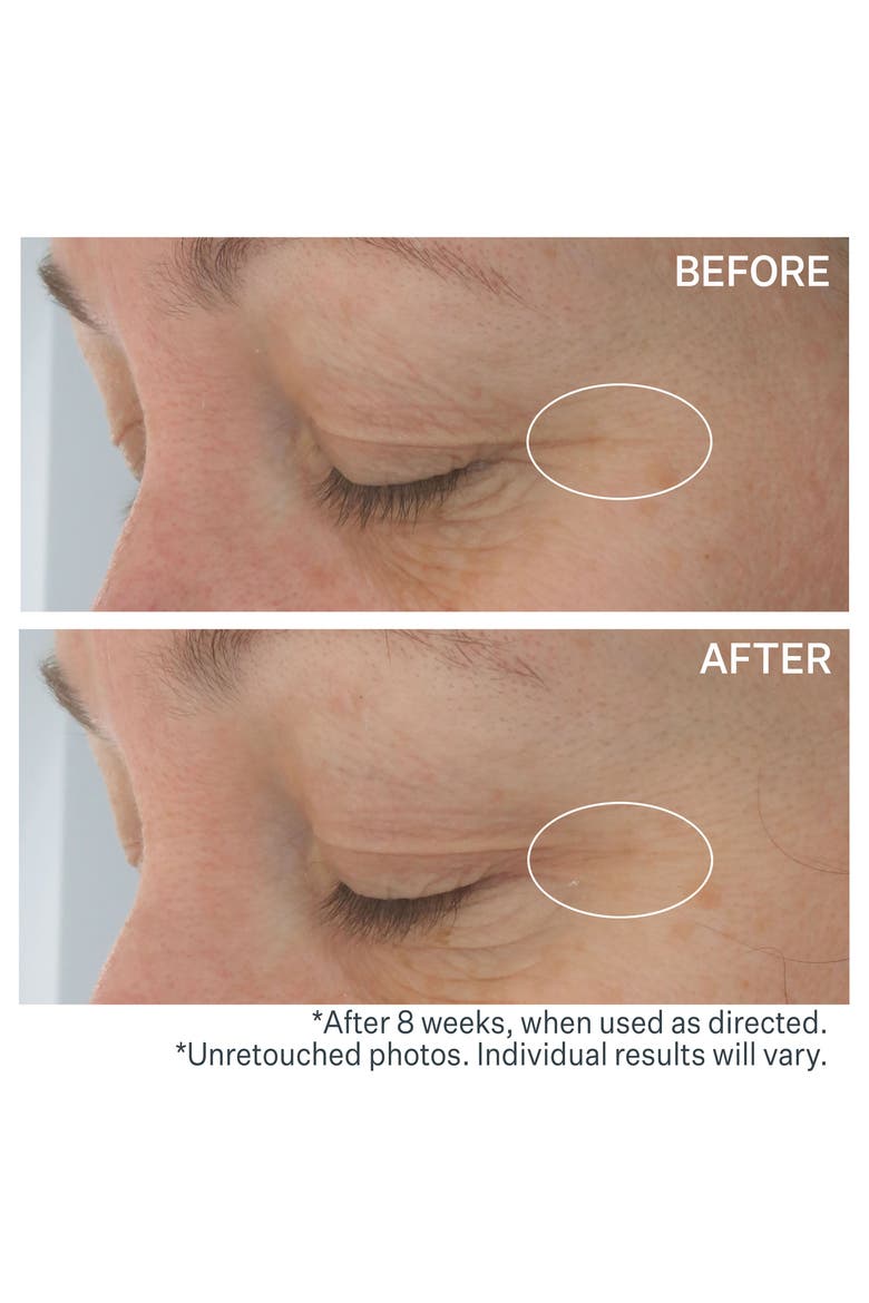 Hyaluronic Tripeptide Gel-Cream for Eyes, Alternate, color, NO COLOR
