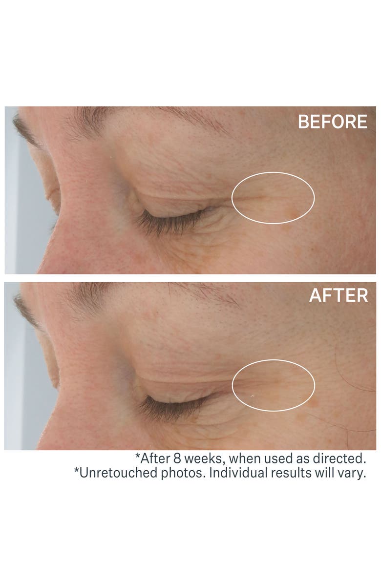 StriVectin<sup>®</sup> Hyaluronic Tripeptide Gel-Cream for Eyes, Alternate, color,