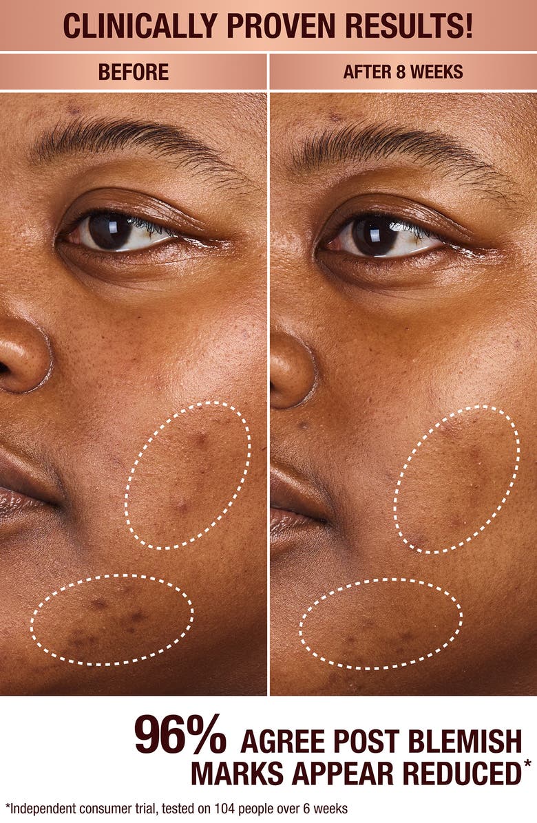 Charlotte Tilbury Dark Spot Correcting Radiance Recovery Serum, Alternate, color,