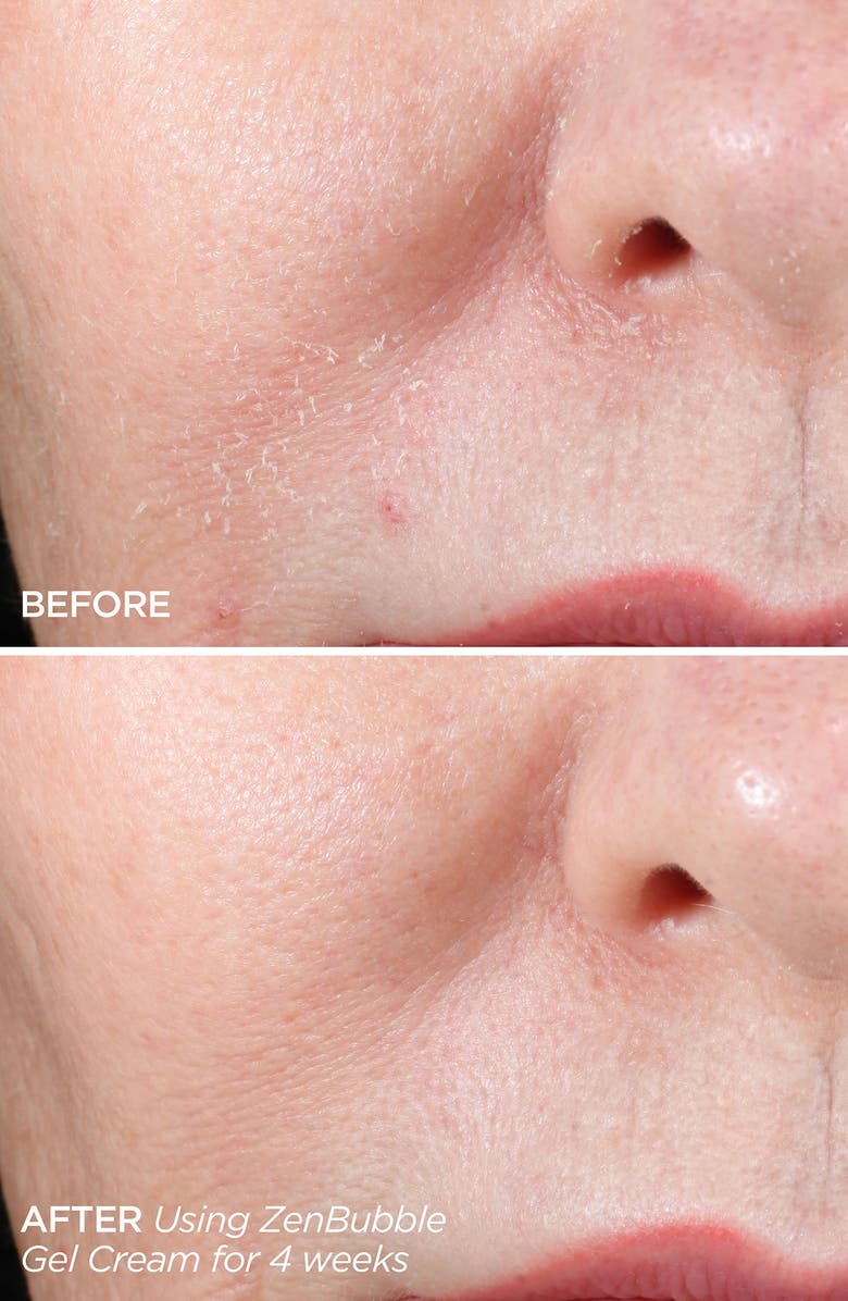 BeautyBio The ZenBubble Gel Cream, Alternate, color, 