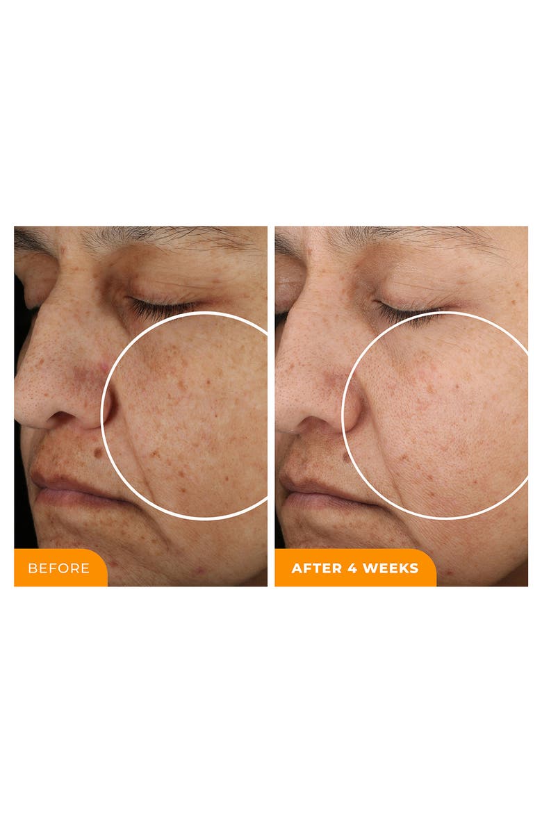 Universal C Skin Refiner Vitamin C Brightening Serum, Alternate, color, NO COLOR