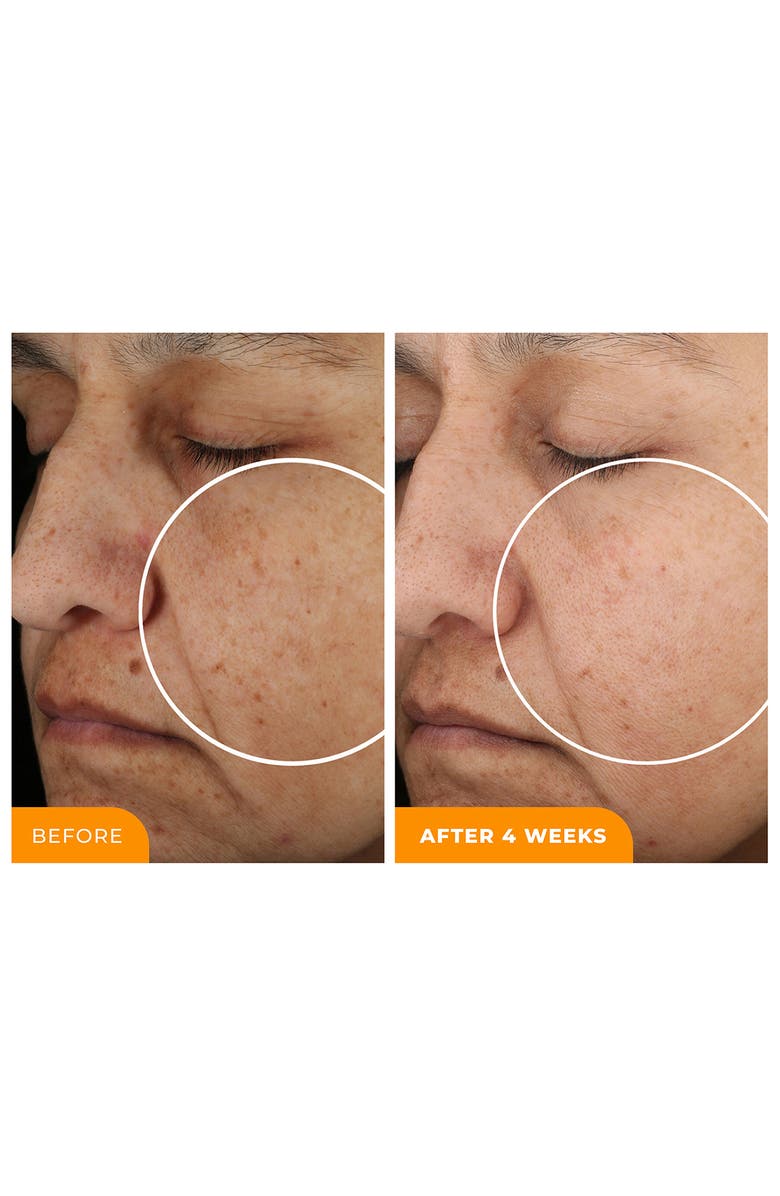 BeautyStat Universal C Skin Refiner Vitamin C Brightening Serum, Alternate, color,