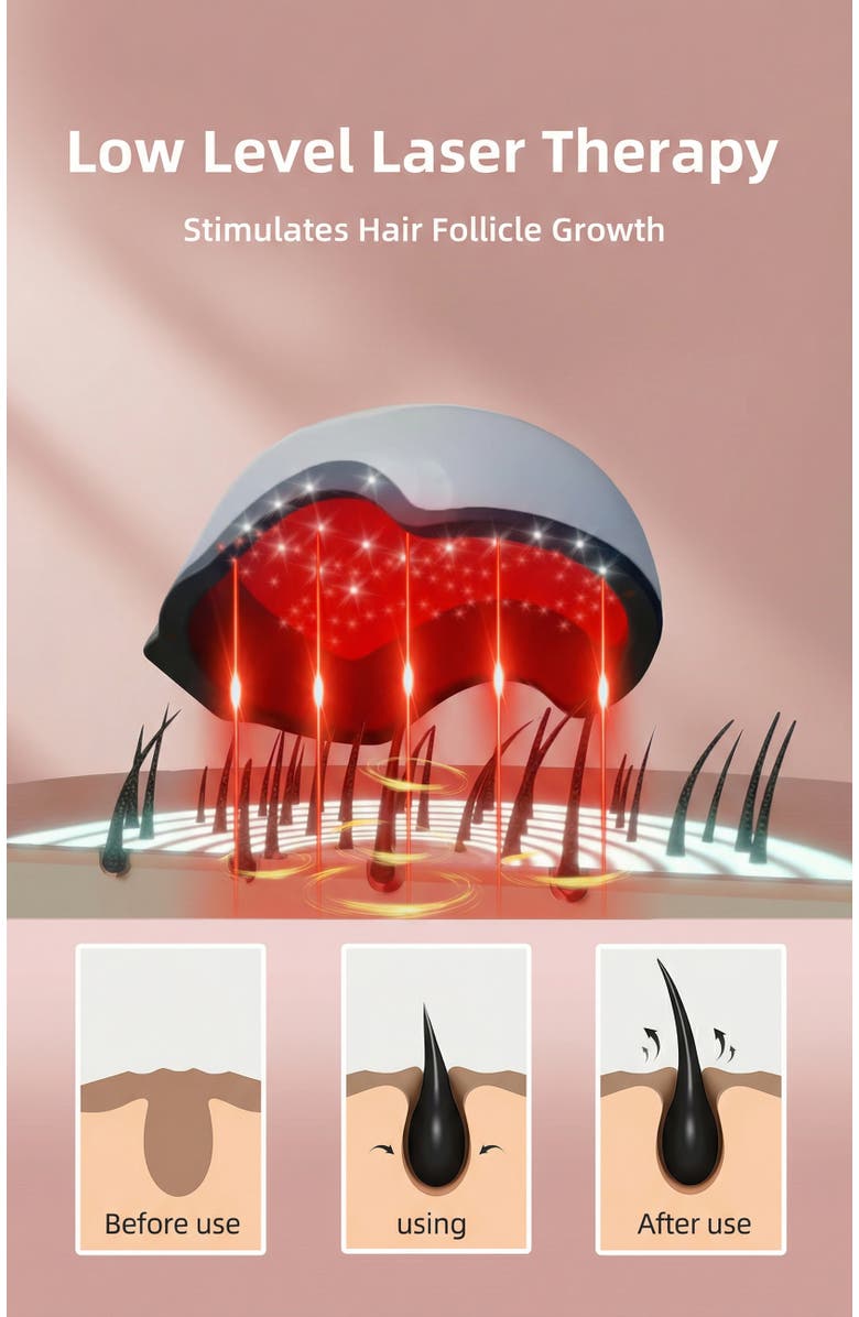 Lovery Laser Red Light Therapy Device for Hair Growth - 650nm Professional System, Alternate, color, White