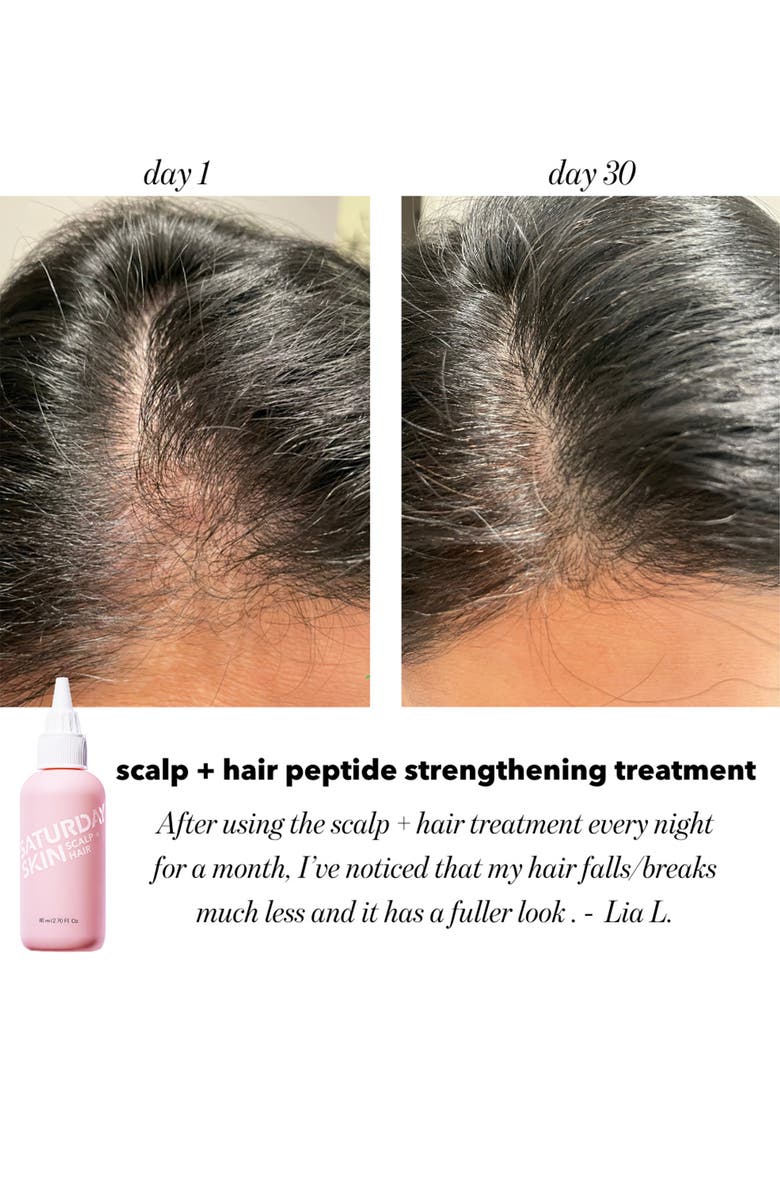 Saturday Skin Scalp + Hair Strengthening Peptide Treatment, Alternate, color,