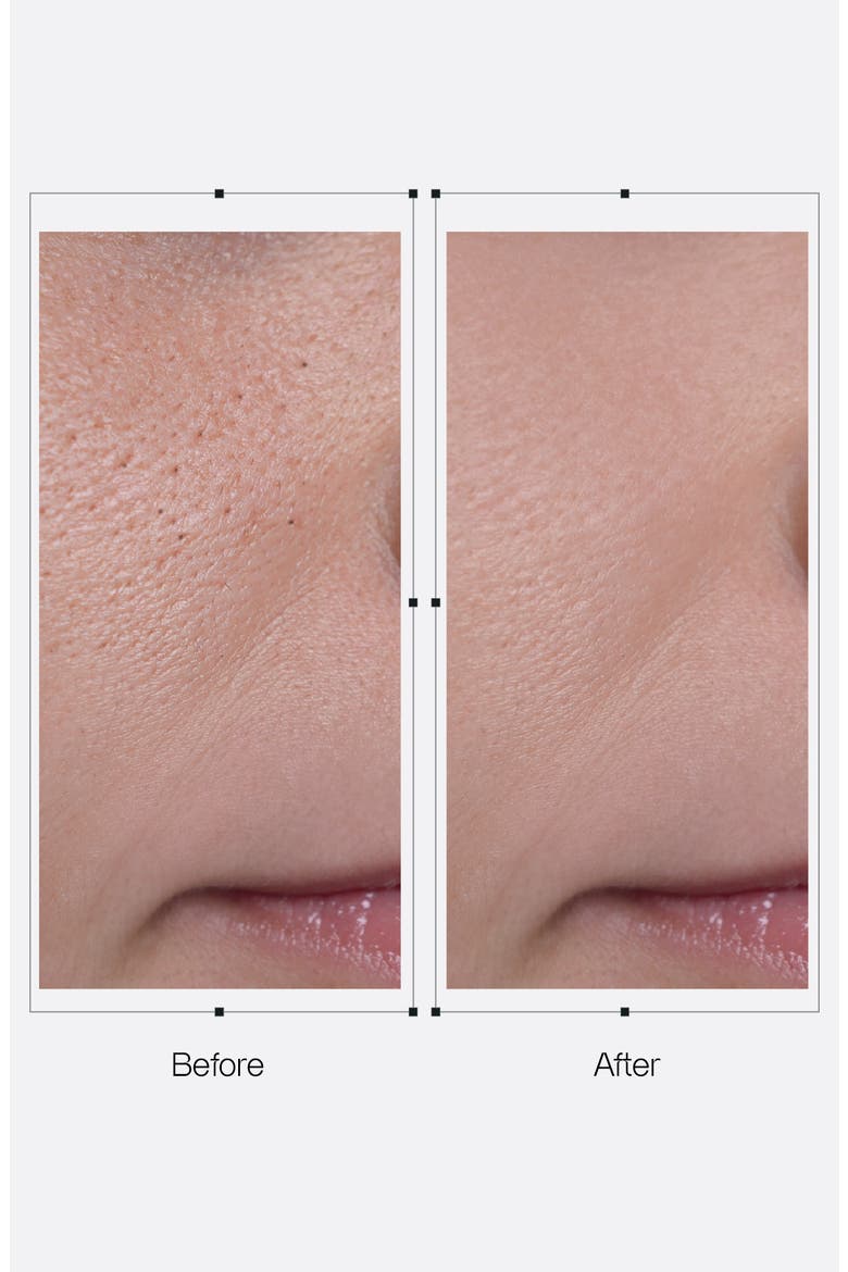 Derx™ Cleanser, Alternate, color, NO COLOR