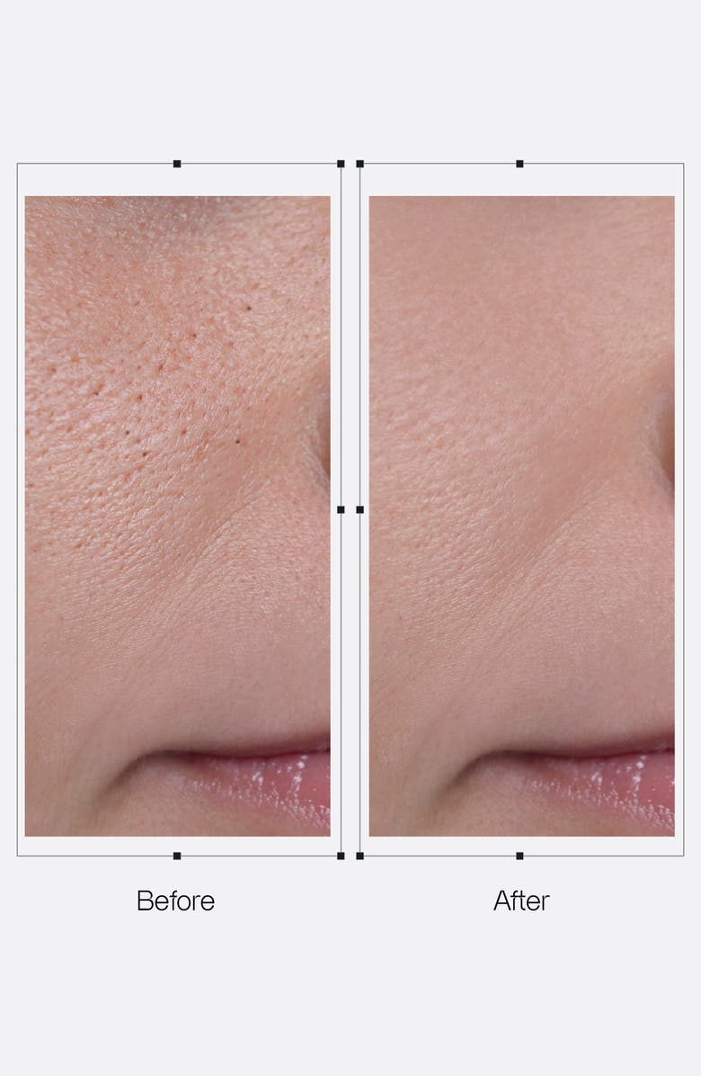 Oganacell Derx<sup>™</sup> Cleanser, Alternate, color,