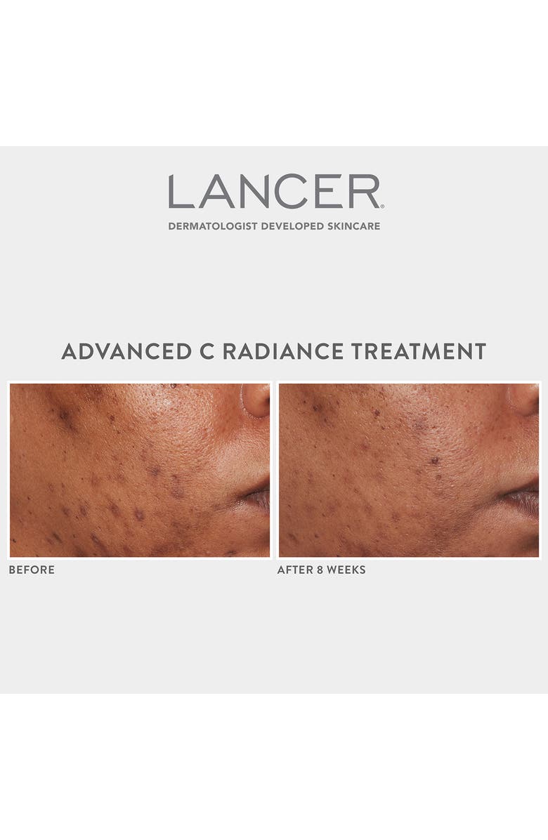 LANCER Skincare Advanced C Radiance Cream, Alternate, color,