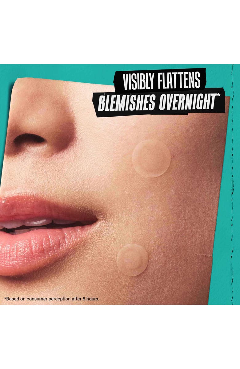 Kiehl's Since 1851 Truly Targeted Overnight Blemish Patches, Alternate, color, 