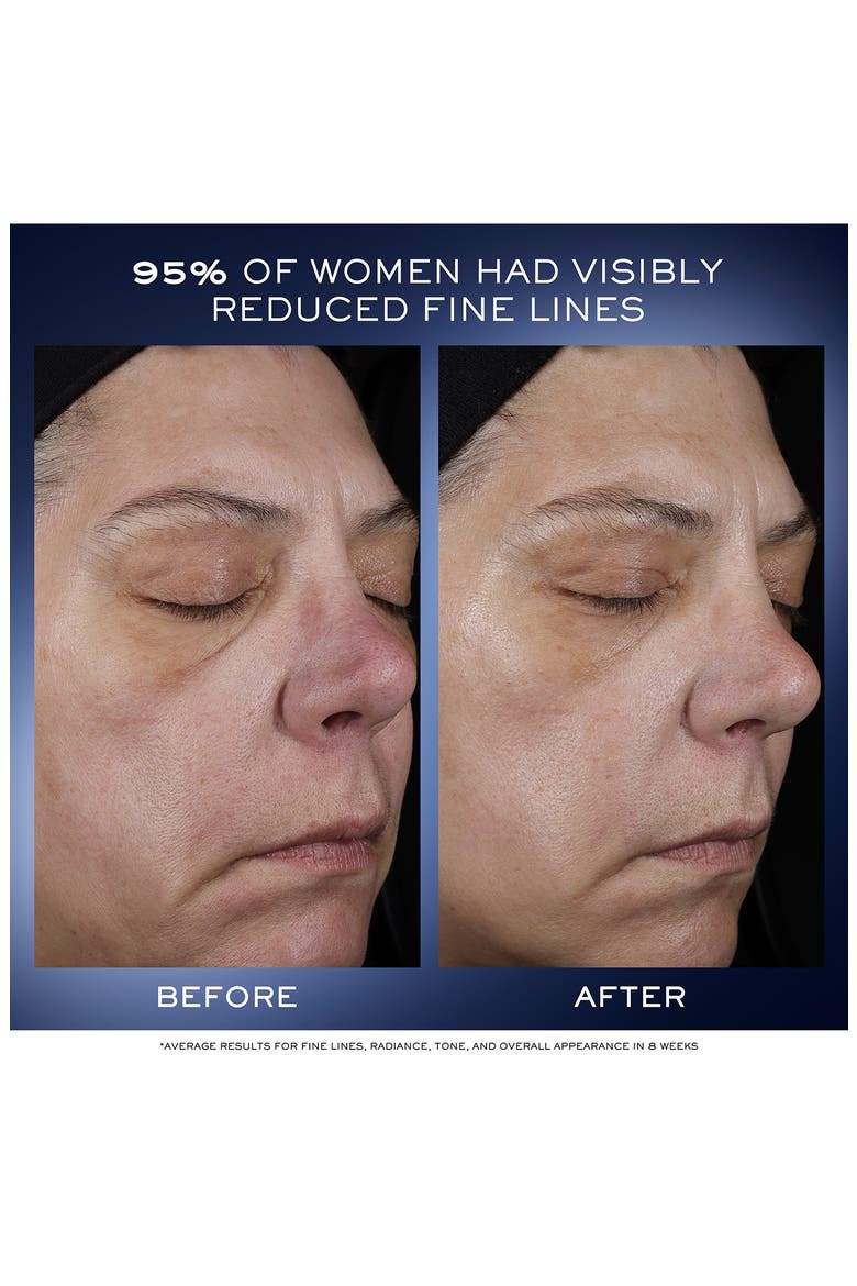 Génifique Ultimate Recovery Serum $260 Value, Alternate, color, NO COLOR