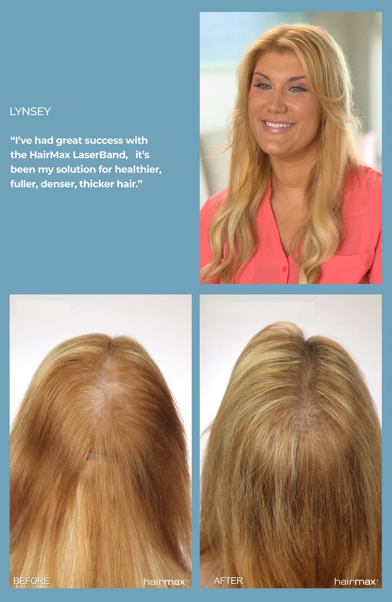 HAIRMAX<sup>®</sup> LaserBand 82 ComfortFlex Hair Growth Device, Alternate, color, Blue