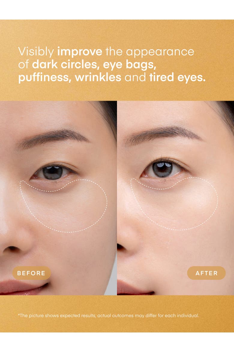 24K Gold Retinol Wrinkle Smoothing Eye Patches, Alternate, color, Gold