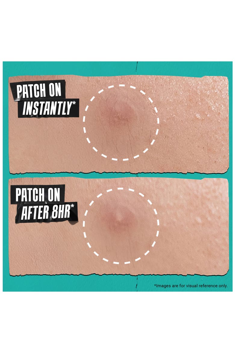 Truly Targeted Overnight Blemish Patches, Alternate, color, NO COLOR