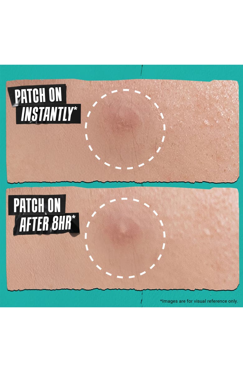 Kiehl's Since 1851 Truly Targeted Overnight Blemish Patches, Alternate, color, 