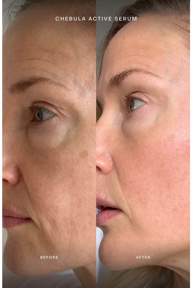 Chebula Active Serum Duo $180 Value, Alternate, color, NO COLOR