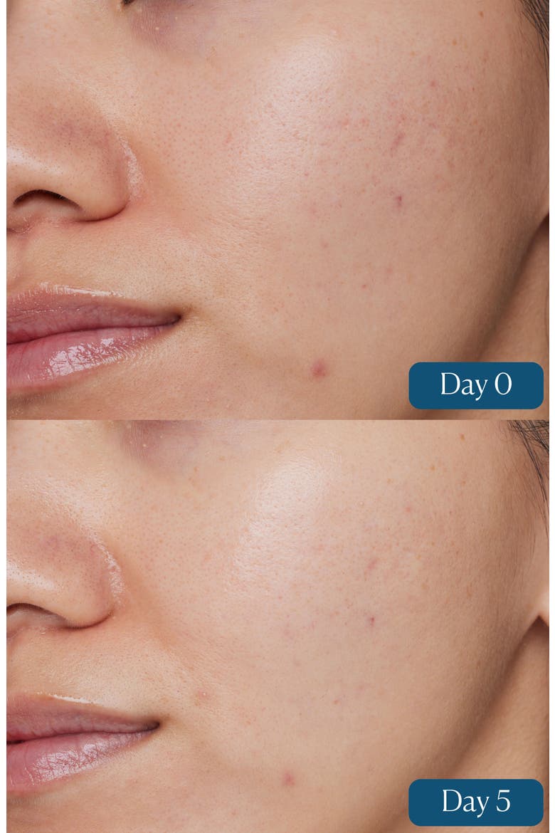 Dynamic Resurfacing Super-C Serum, Alternate, color, NO COLOR