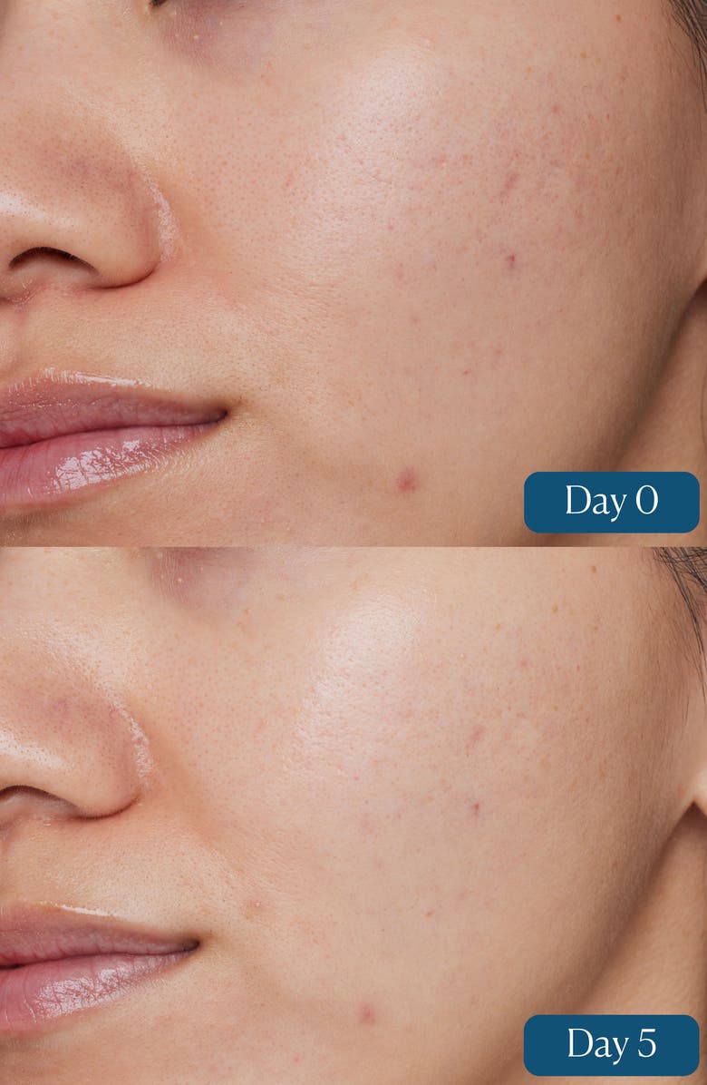 Elemis Dynamic Resurfacing Super-C Serum, Alternate, color,