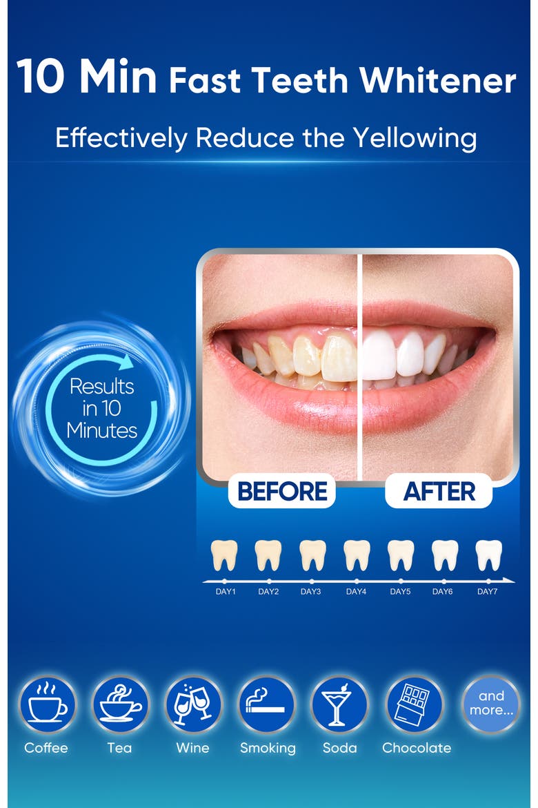 Teeth Whitening Kit with 28 LED Light, 22% CP Teeth Whitening Gel, Alternate, color, Deep Blue