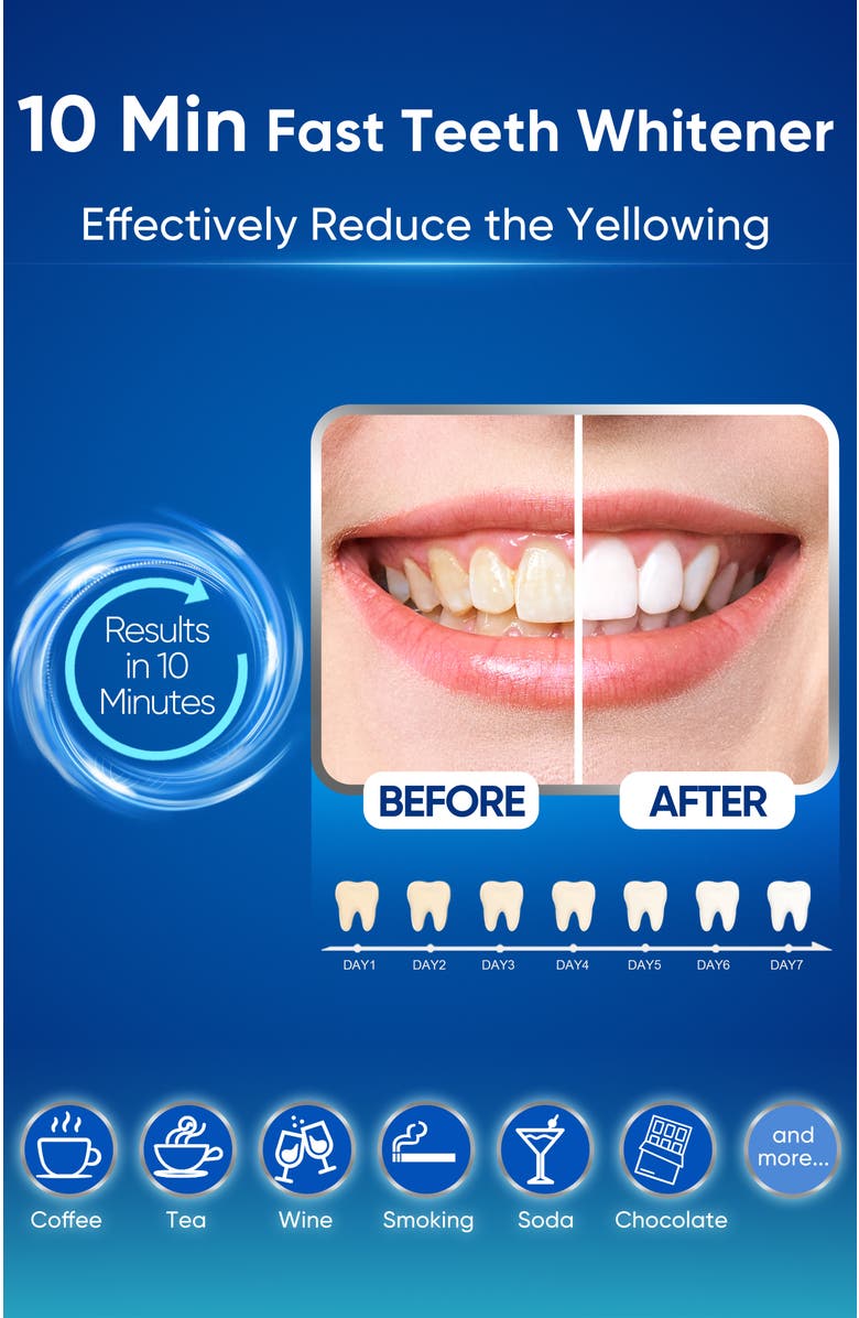 MySmile Teeth Whitening Kit with 28 LED Light, 22% CP Teeth Whitening Gel, Alternate, color, Deep Blue