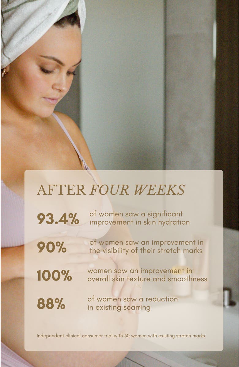 PURE MAMA Bump Love Set, Alternate, color, NO COLOR