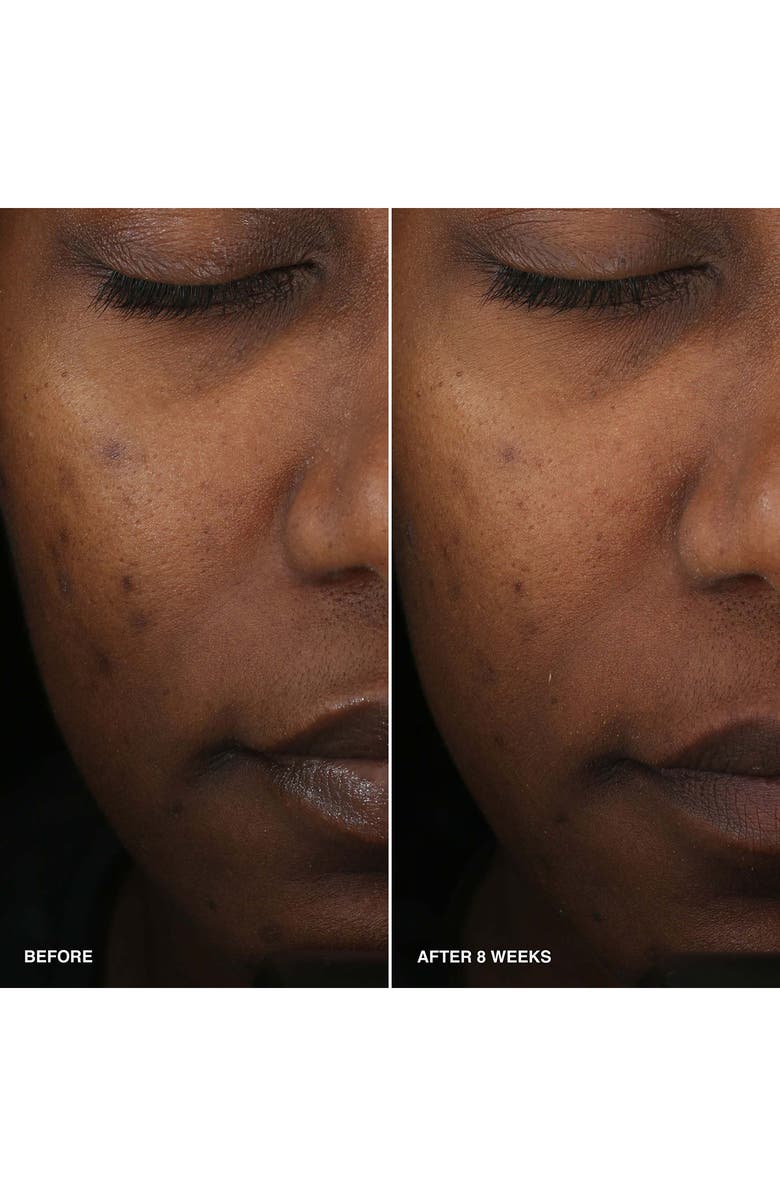 Bobbi Brown Vitamin Enriched Smoothing Serum Home & Away Duo $98 Value, Alternate, color,