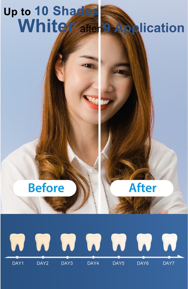 MySmile Teeth Whitening Gel Refill Pack, 3 Non-Sensitive Teeth Whitening Gel, Alternate, color, Clear