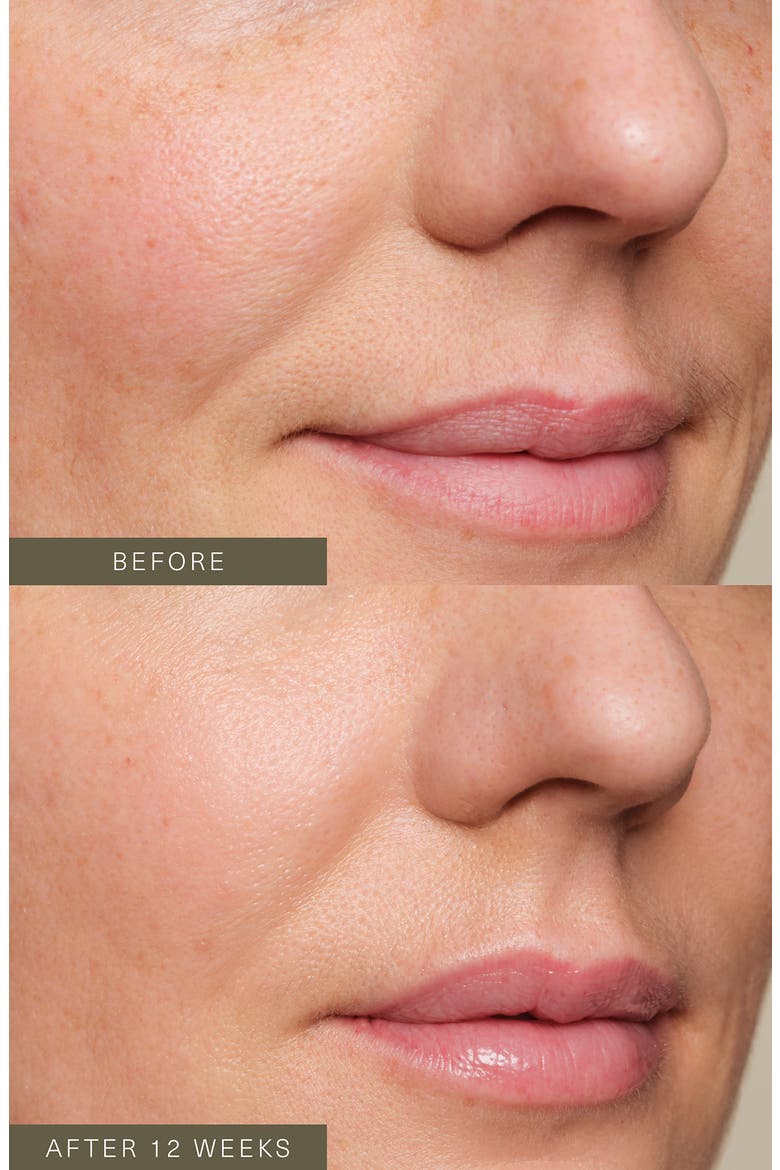Firming Plant Peptide Serum, Alternate, color, NO COLOR