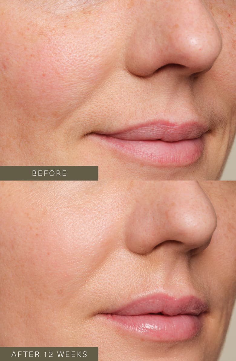 Oak Essentials Firming Plant Peptide Serum, Alternate, color,