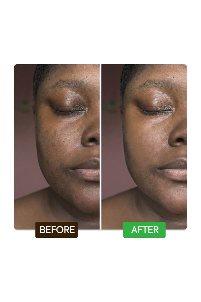 Kojic & Azelaic Brightening Serum, Alternate, color, None