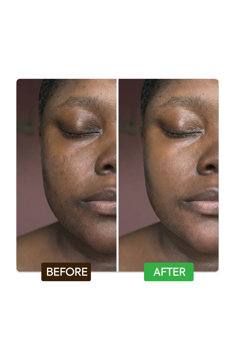 Makari de Suisse Kojic & Azelaic Brightening Serum, Alternate, color, NO COLOR