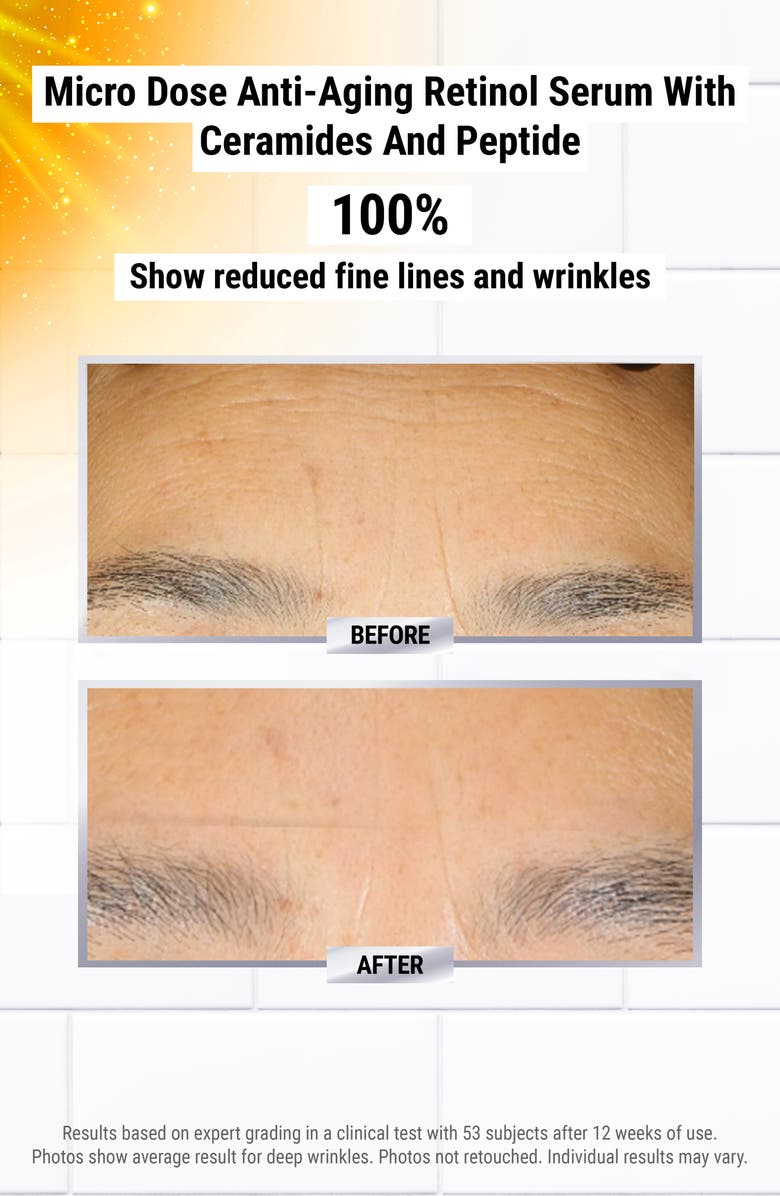 Kiehl's Since 1851 Day-to-Night Line-Reducing Set USD $151 Value, Alternate, color,