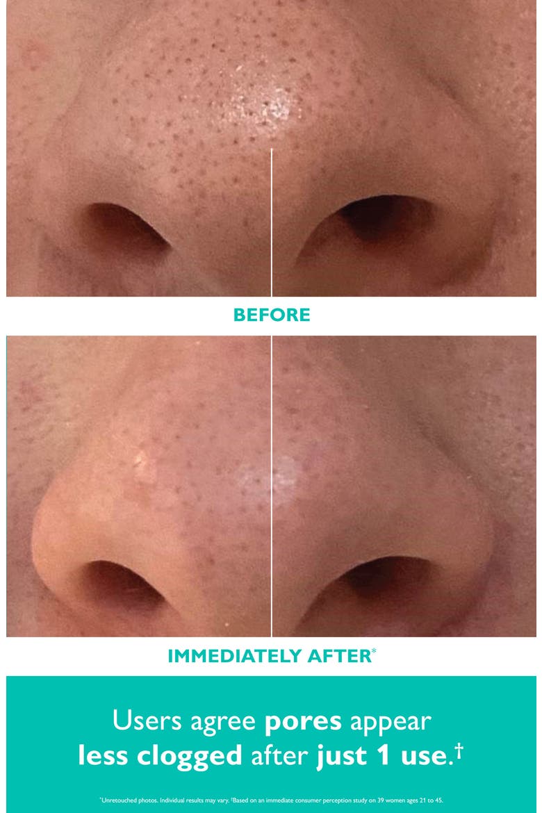 Even Smoother™ Microdermabrasion Exfoliating Pore Purifier, Alternate, color, NO COLOR