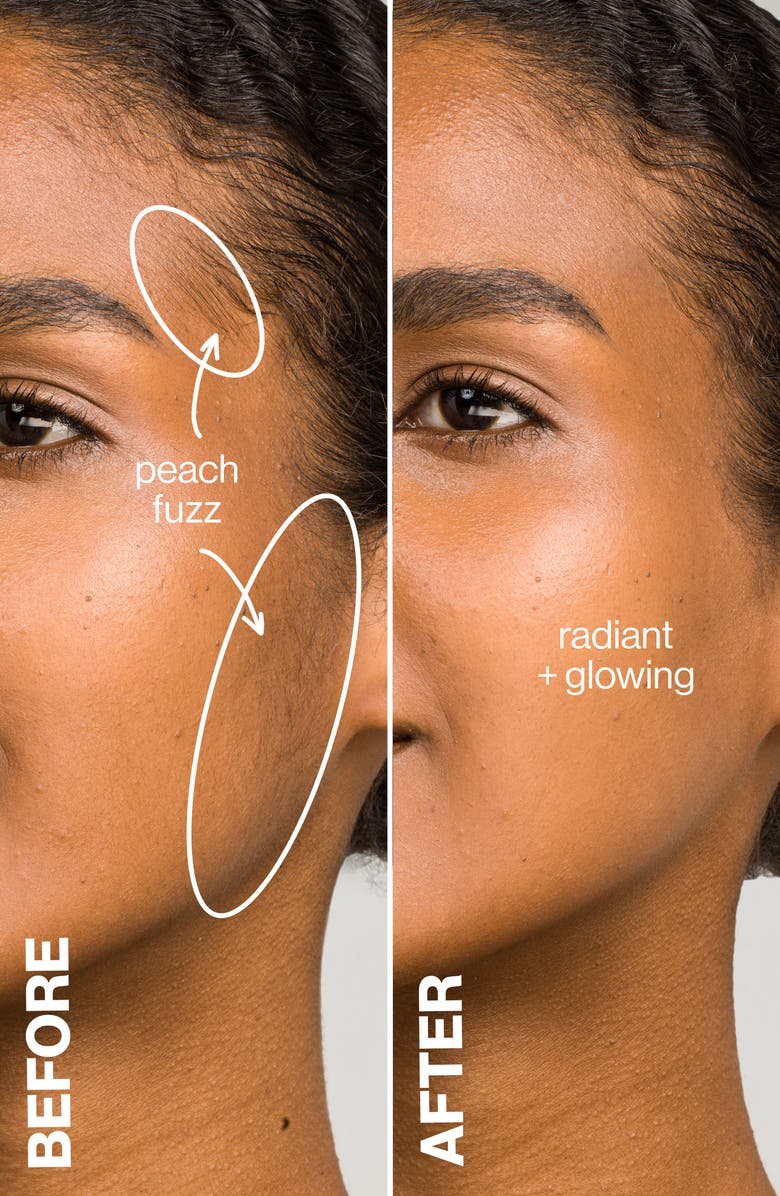 DERMAFLASH LUXE Anti-Aging Sonic Dermaplaning + Peach Fuzz Removal Device, Alternate, color,