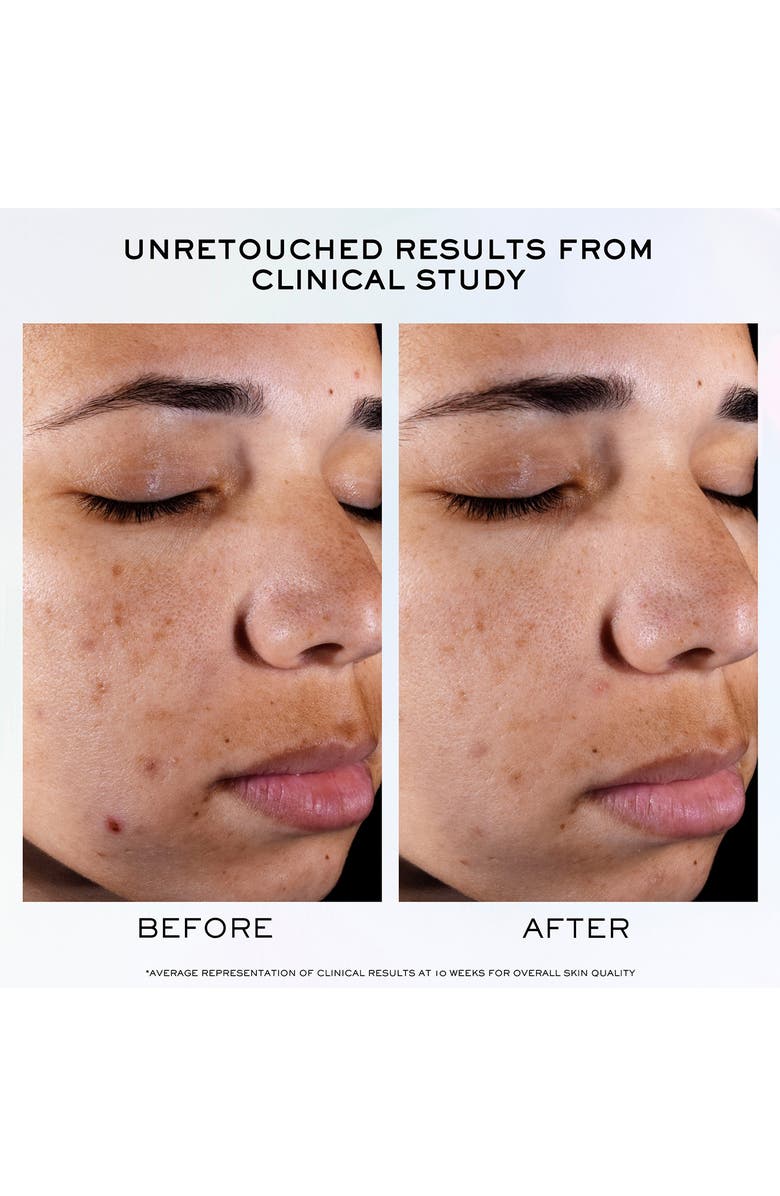 Lancôme Clarifique Serum, Alternate, color,