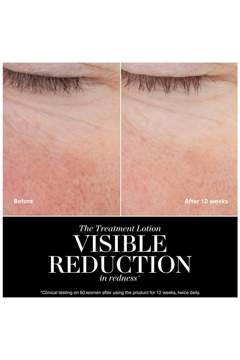 The New Treatment Lotion for Hydration & Anti-Aging, Alternate, color, NO COLOR