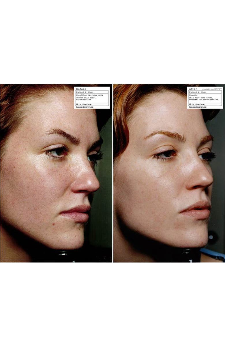 Somme Institute Transport Two, Alternate, color, 