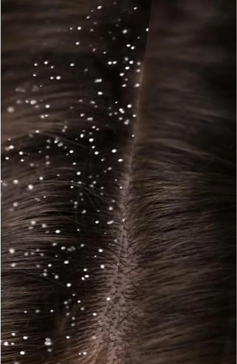 NUME Dandruff Shampoo | Vegan Scalp-Soothing Cleanser, Alternate, color, Blue