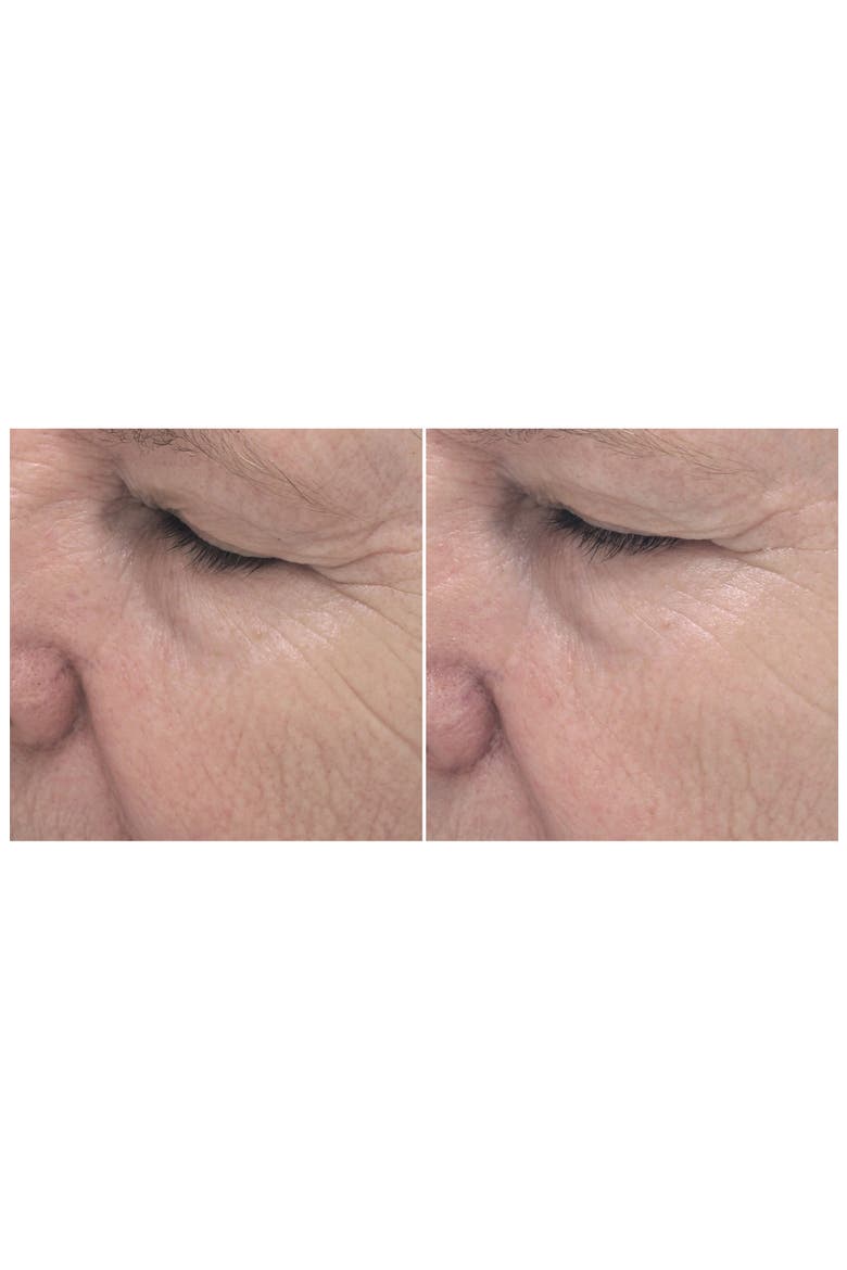 ExLinea Peptide Smoothing Serum, Alternate, color, NO COLOR