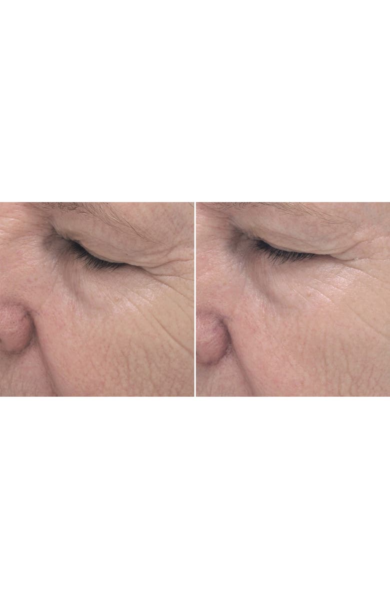 PCA Skin ExLinea Peptide Smoothing Serum, Alternate, color, 