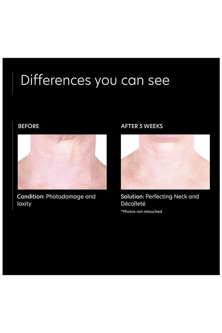 Perfecting Neck & Décolleté Cream, Alternate, color, NO COLOR