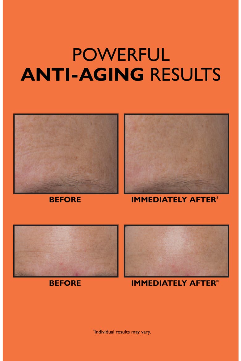 Anti-Aging Triple Acid Peel, Alternate, color, NO COLOR