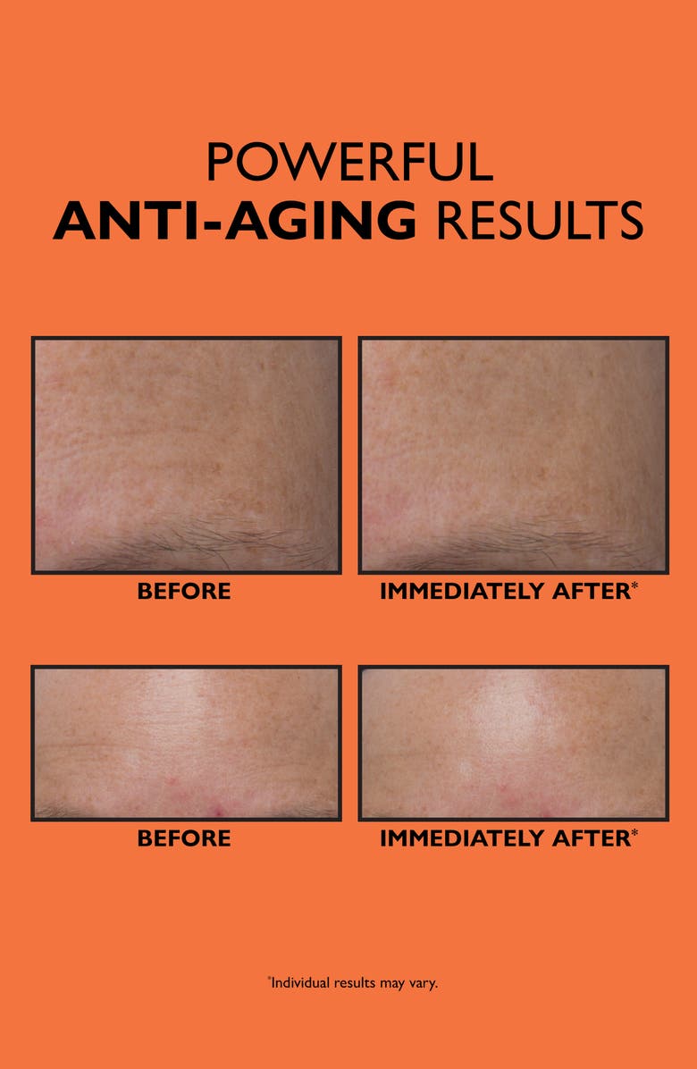 Peter Thomas Roth Anti-Aging Triple Acid Peel, Alternate, color, 
