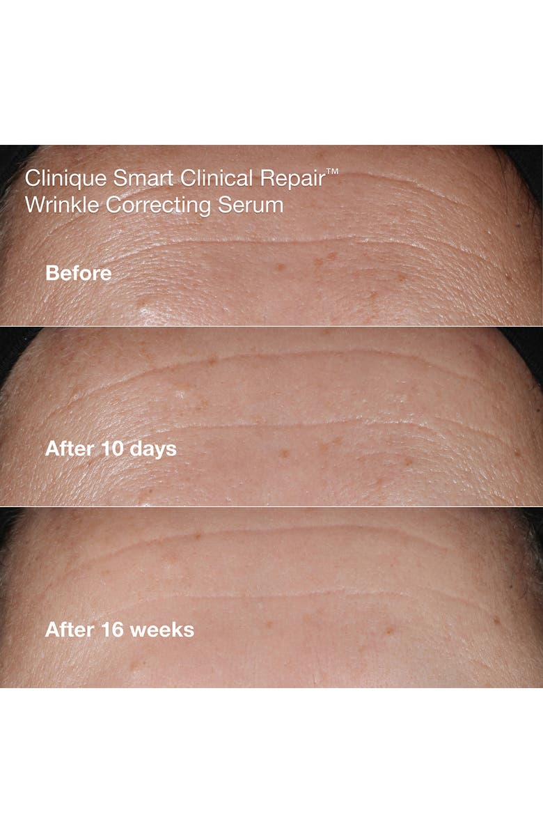 Clinique A+ De-Agers Anti-Aging Skin Care Set (Limited Edition) $173 Value, Alternate, color, 